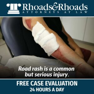 road rash