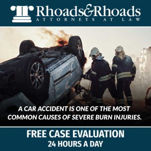 burn injuries car accident