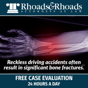 bone fractures